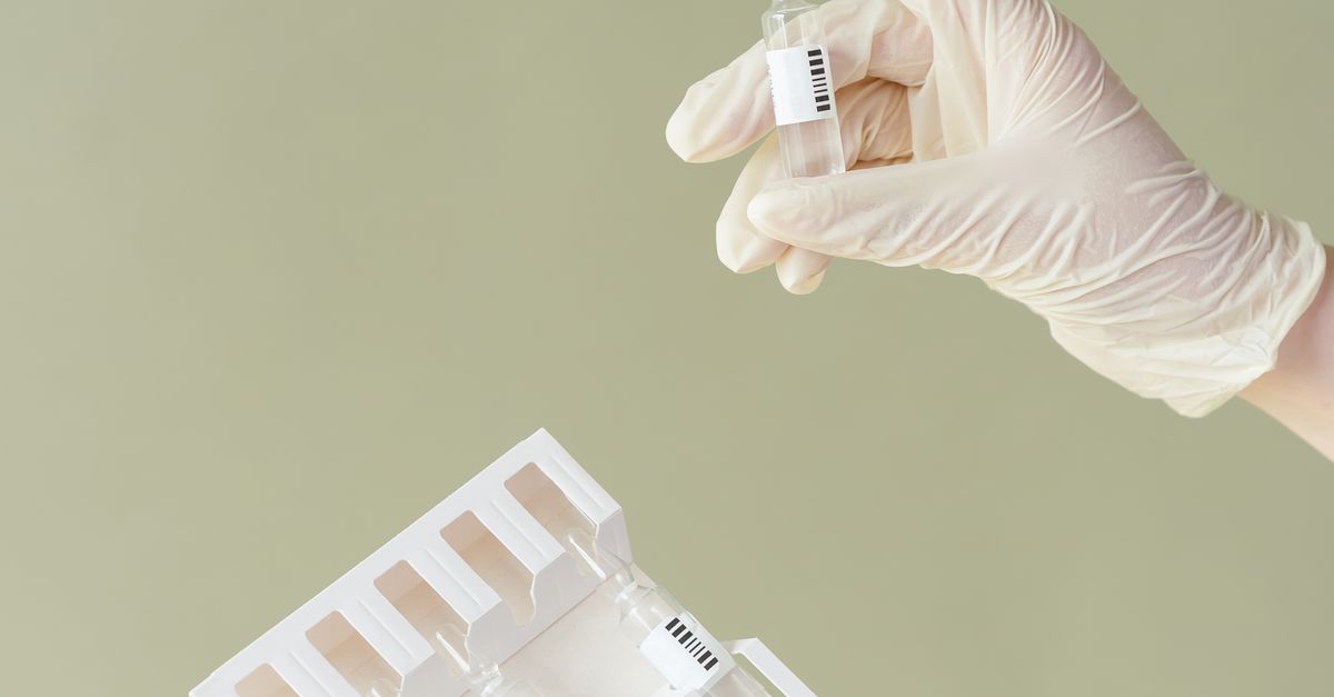 Peptide-Based Approaches for Reducing Appetite
